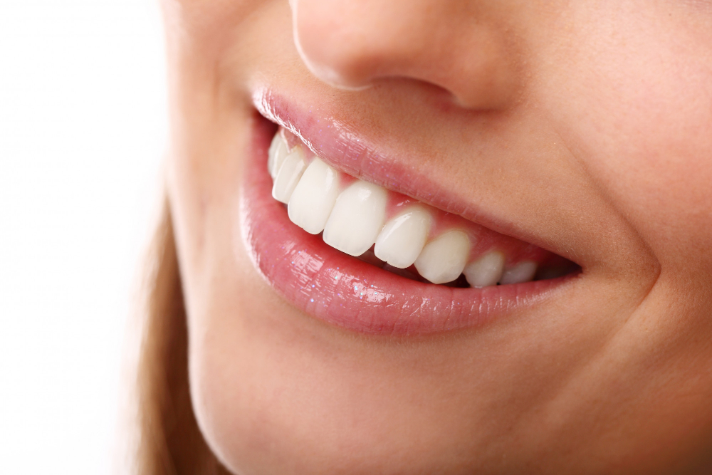 Enhancing Your Smile with Veneers in Colombia: A Comprehensive Guide